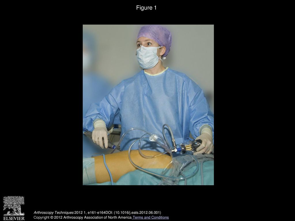 Endoscopic Bursectomy And Iliotibial Tract Release As A Treatment For